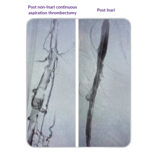 pre and post image